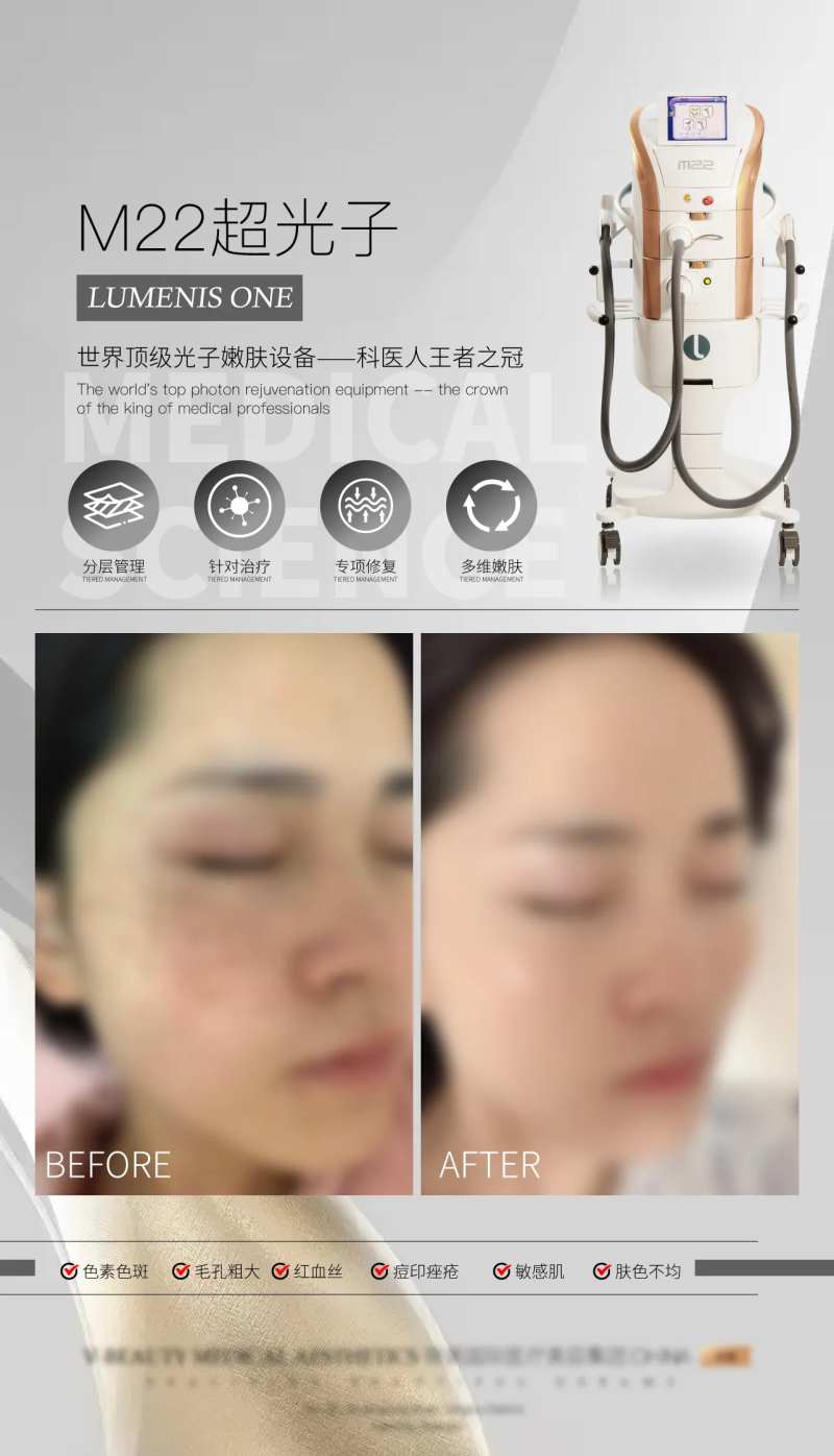 光子嫩肤案例对比海报-采灵感-cailinggan.com