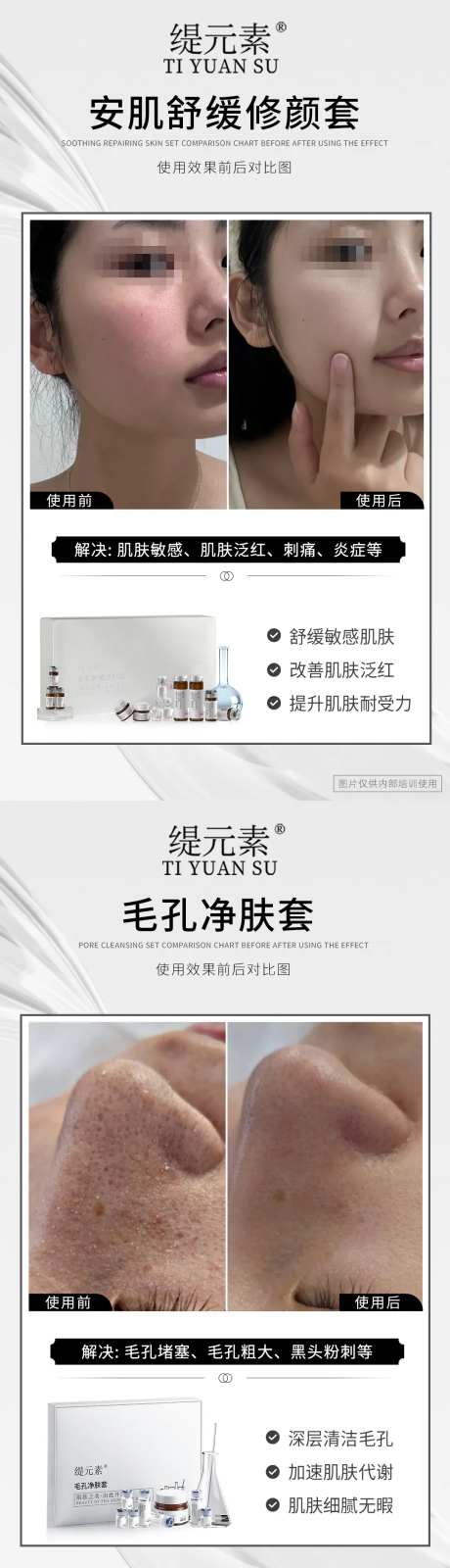 毛孔清洁对比图-采灵感-https://www.cailinggan.com/