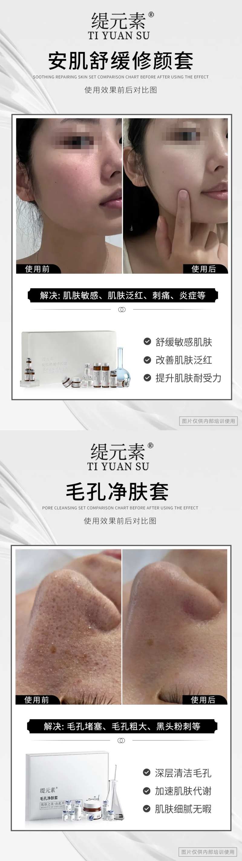 毛孔清洁对比图-采灵感-cailinggan.com