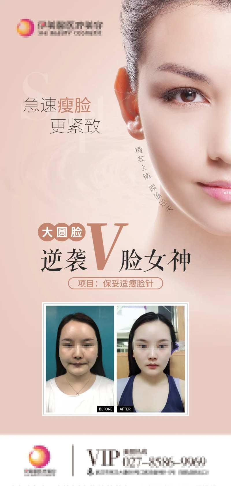医美瘦脸针v脸海报-采灵感-cailinggan.com