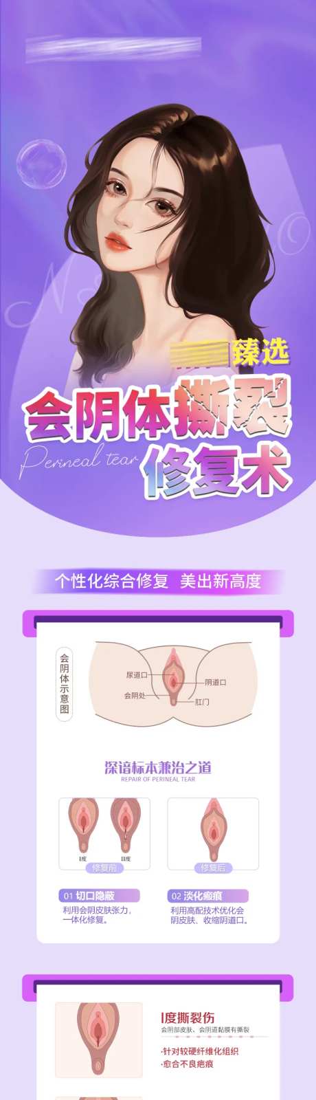 医美会阴体撕裂修复术-采灵感-https://www.cailinggan.com/