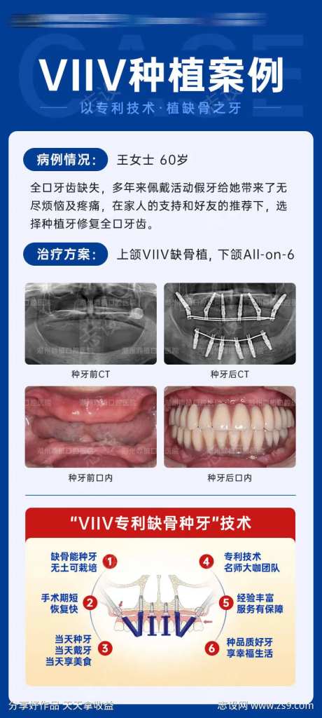 全口种植牙案例对比图海报-采灵感-https://www.cailinggan.com/
