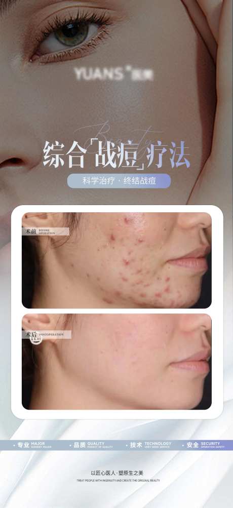 医美痘肌管理案例对比-采灵感-https://www.cailinggan.com/