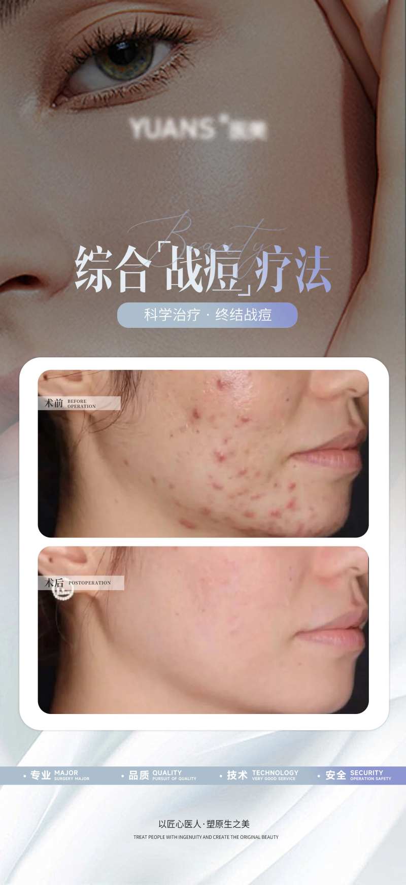 医美痘肌管理案例对比-采灵感-cailinggan.com