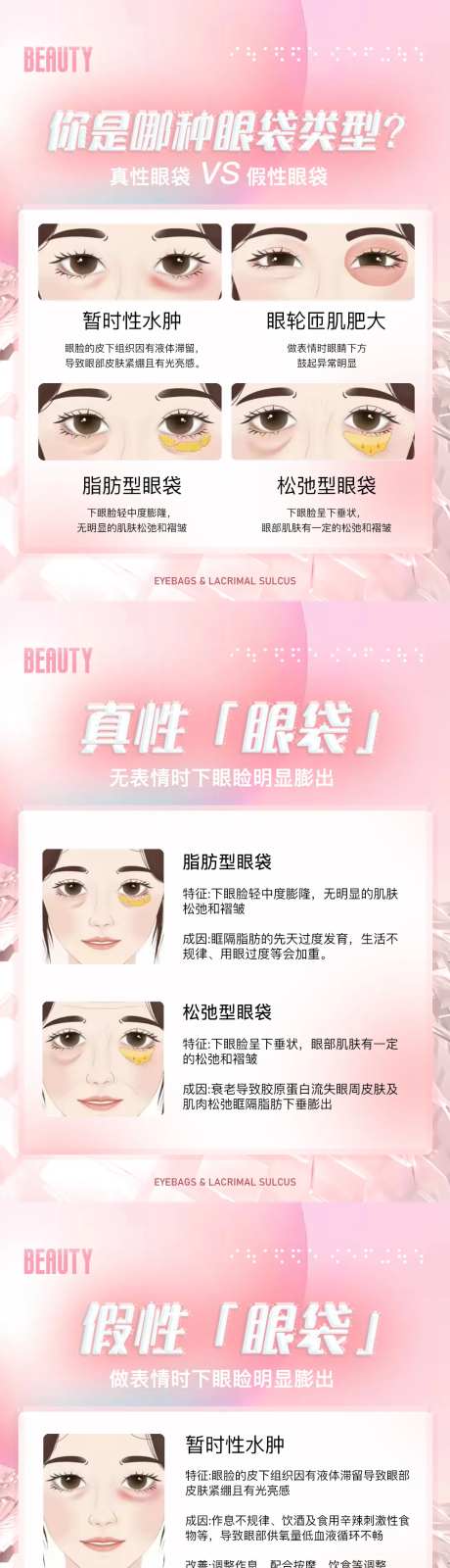 医美科普眼袋海报-采灵感-https://www.cailinggan.com/