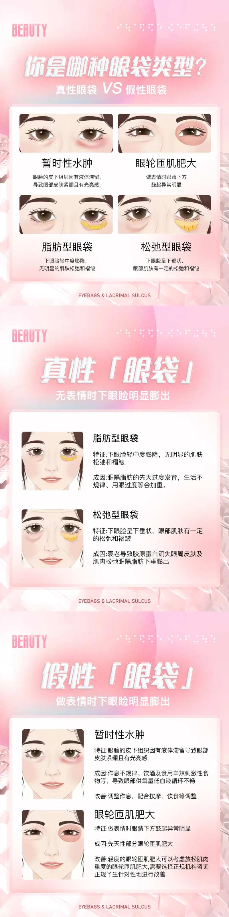 医美科普眼袋海报-采灵感-cailinggan.com