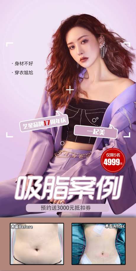 腰腹环吸医美海报-采灵感-https://www.cailinggan.com/