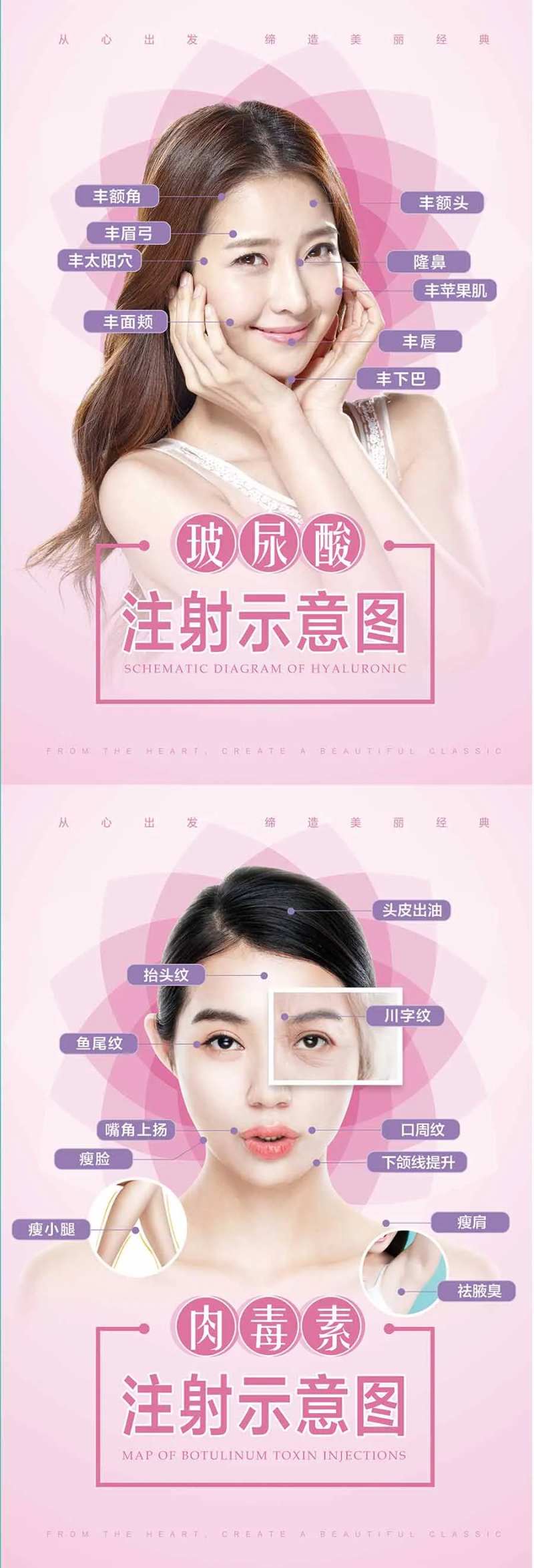 医美玻尿酸肉毒素注射部位图展示海报-采灵感-cailinggan.com