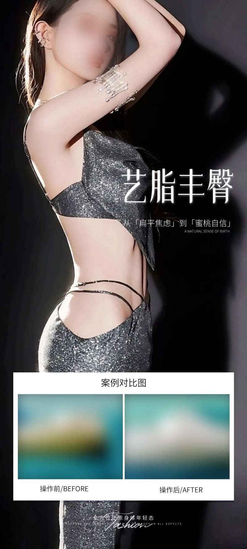 医美丰臀案例海报-采灵感-cailinggan.com