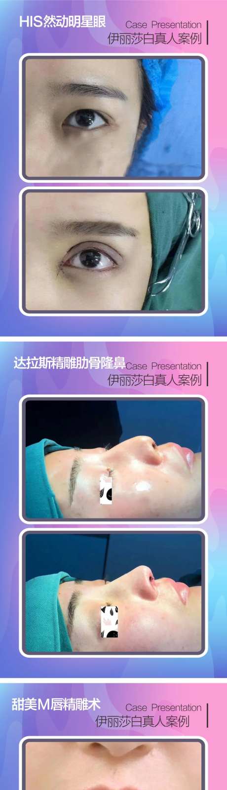 医美眼鼻唇案例海报-采灵感-https://www.cailinggan.com/