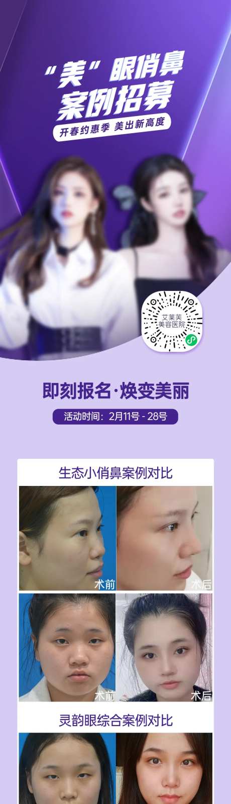 医美美眼俏鼻体验官案例招募-采灵感-https://www.cailinggan.com/