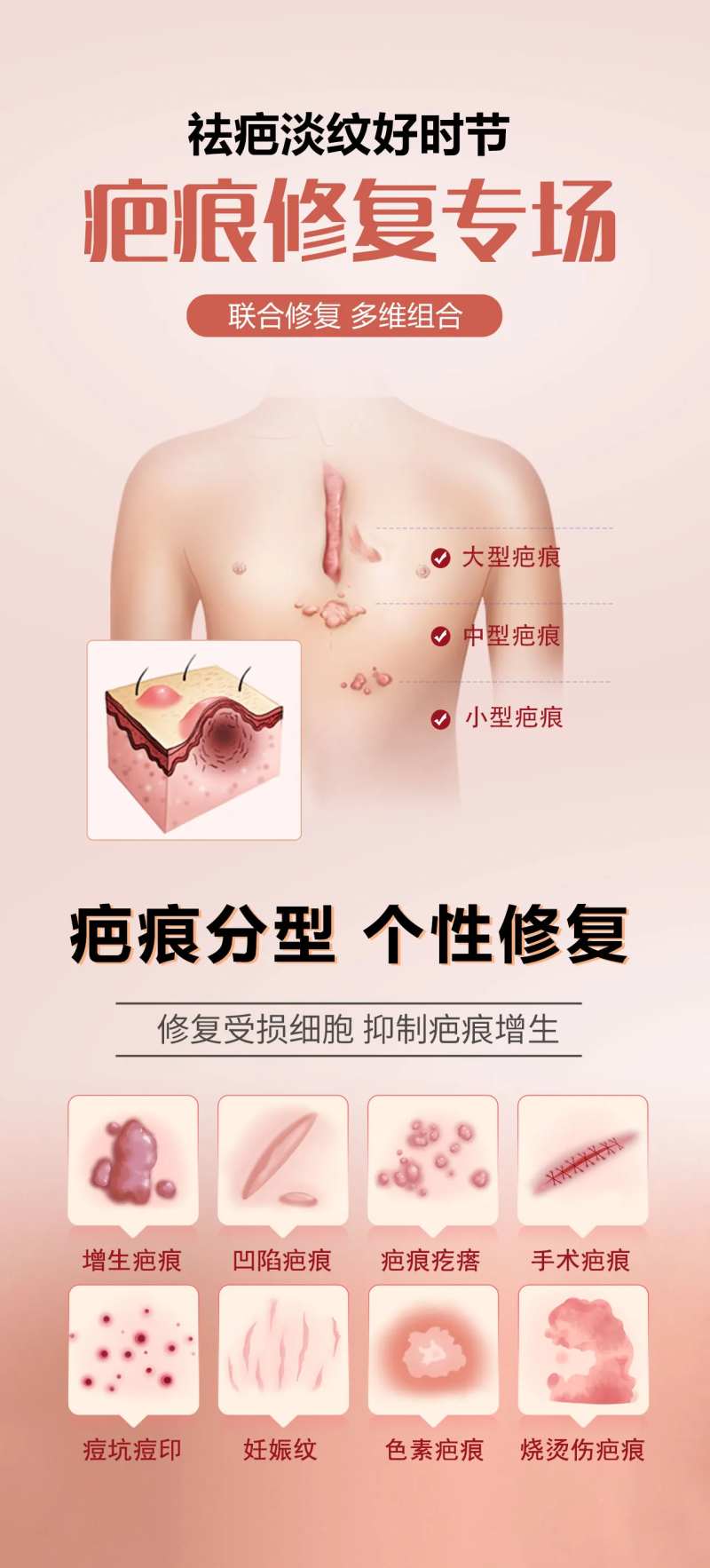 疤痕修复专场-采灵感-cailinggan.com