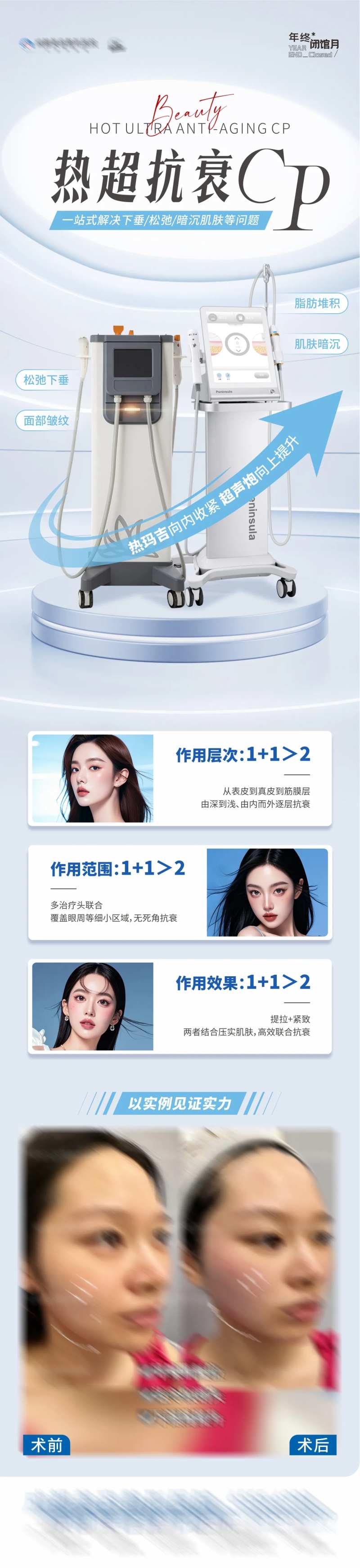 医美热玛吉超声炮仪器抗衰案例长图-采灵感-cailinggan.com