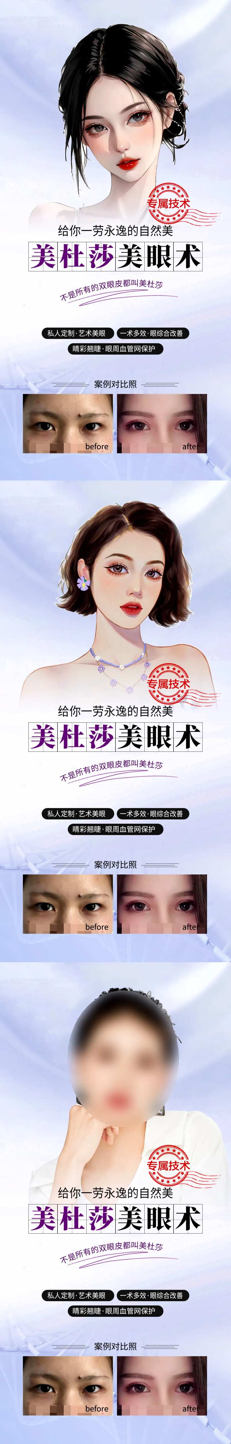 医美双眼皮案例海报-采灵感-cailinggan.com