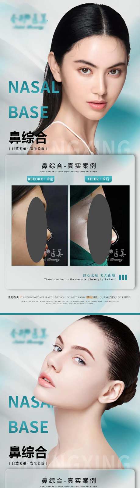 医美眼综合案例海报-采灵感-https://www.cailinggan.com/