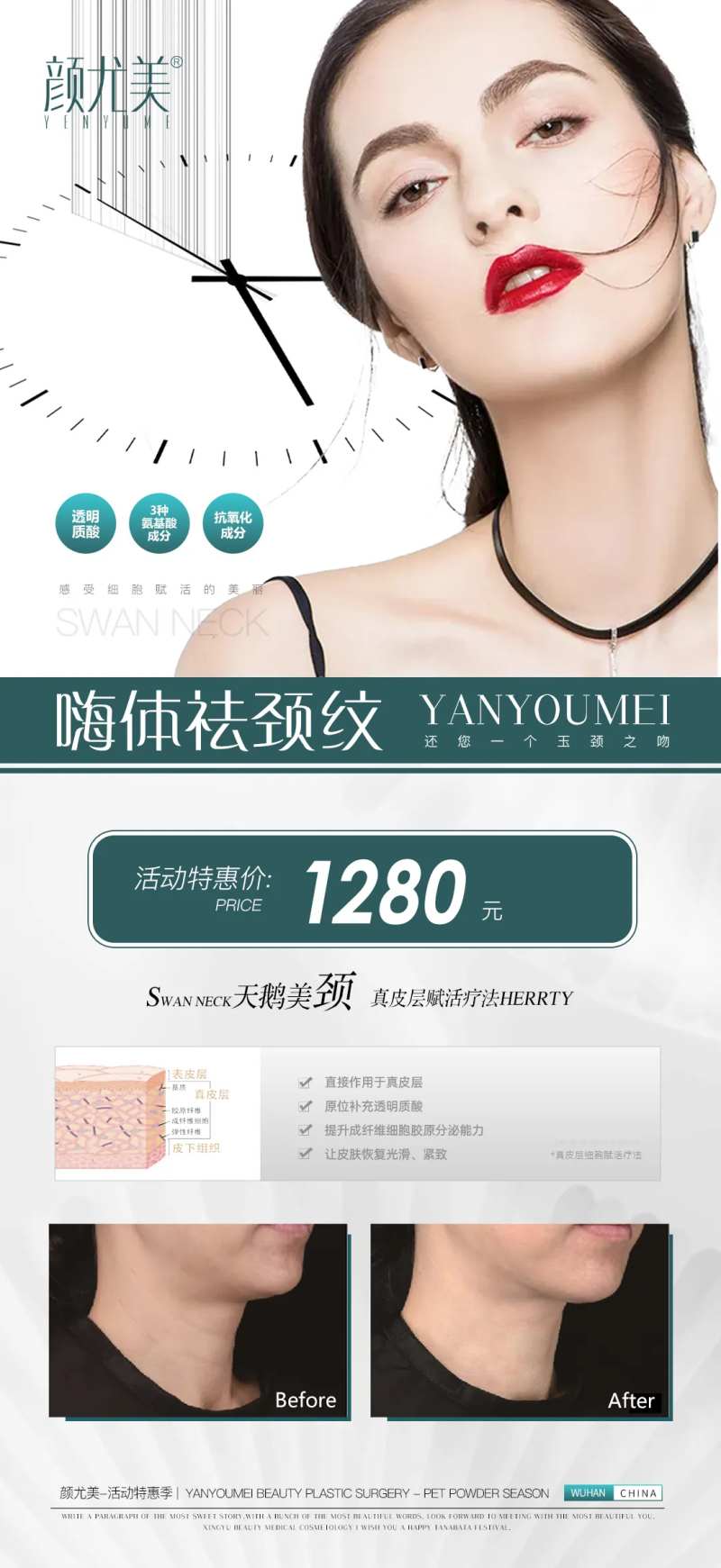 医美嗨体去颈纹促销海报-采灵感-cailinggan.com
