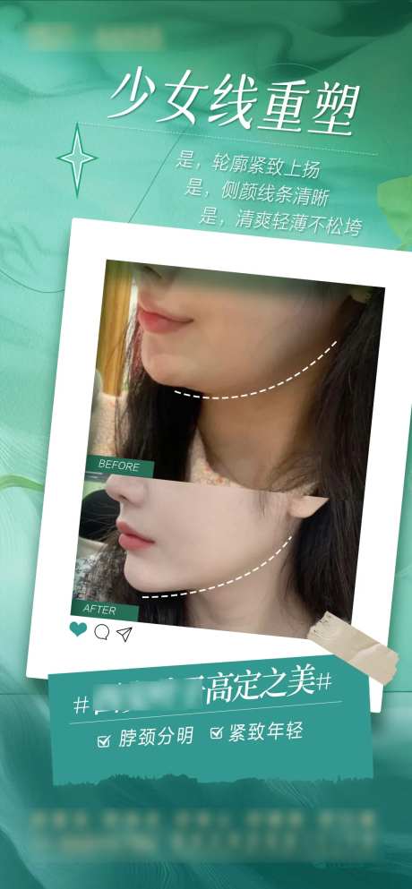 少女线下颌缘案例海报-采灵感-https://www.cailinggan.com/