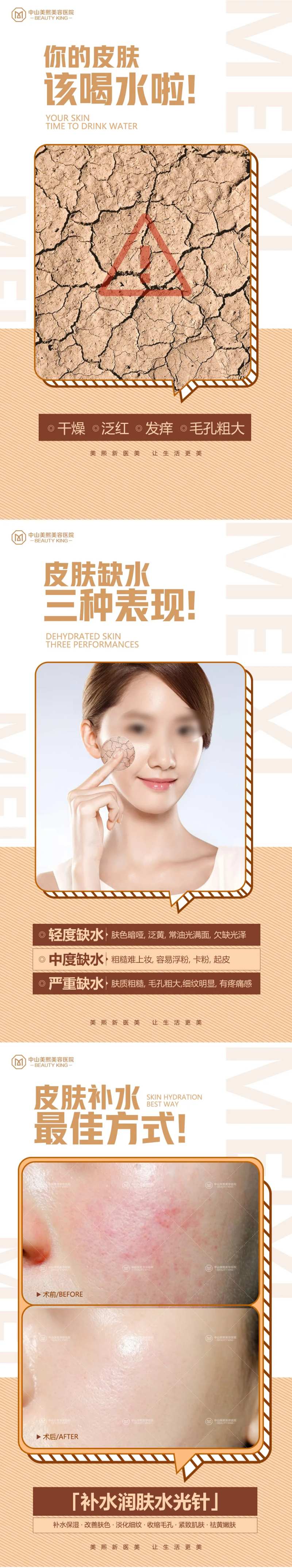 皮肤干燥问题海报-采灵感-cailinggan.com