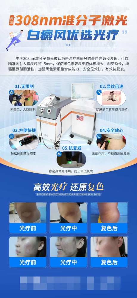 蓝色科普海报白癜风设备308光疗仪器-采灵感-https://www.cailinggan.com/