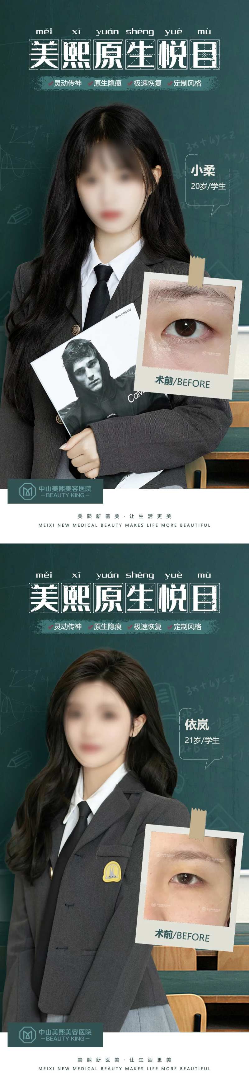 毕业季双眼皮案例海报-采灵感-cailinggan.com