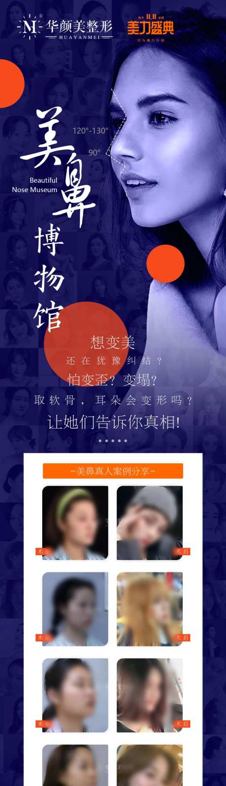 鼻整形 -采灵感-https://www.cailinggan.com/