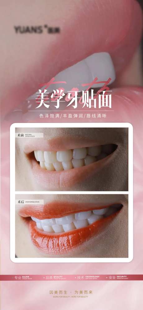 医美牙齿贴面案例海报-采灵感-https://www.cailinggan.com/