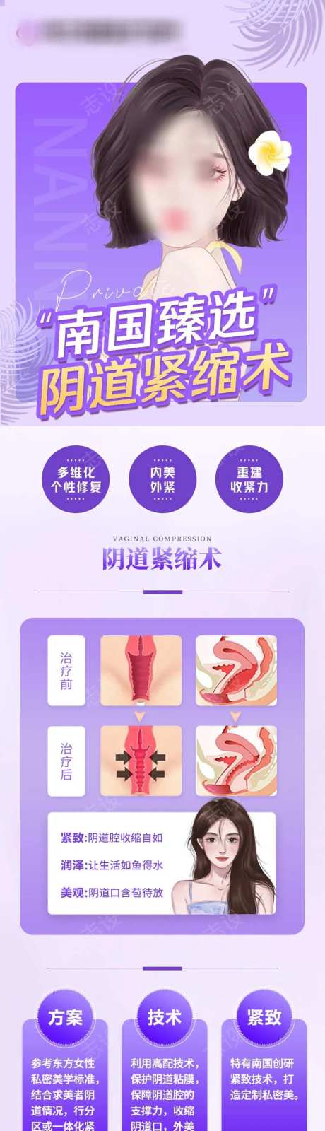 阴道紧缩术-采灵感-https://www.cailinggan.com/