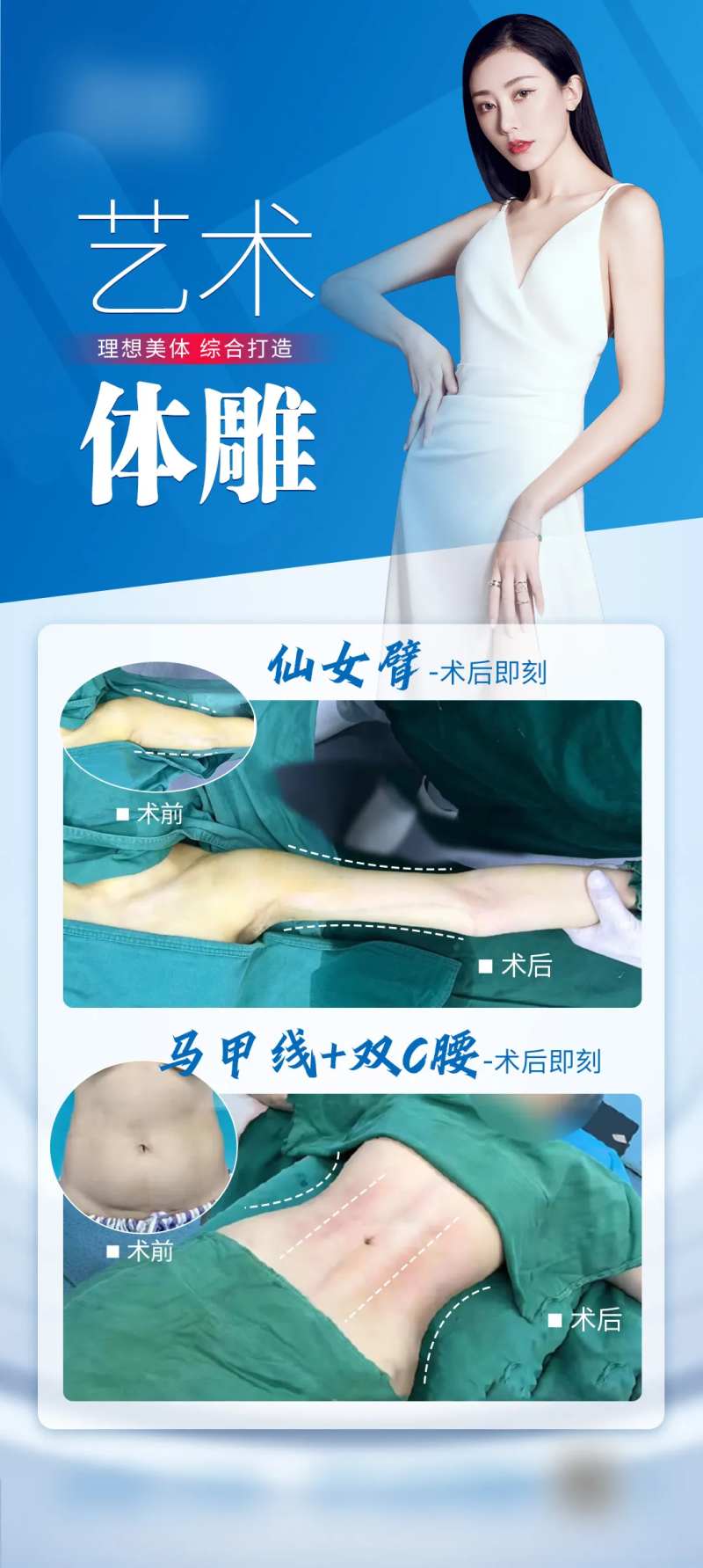 马甲线吸脂案例简约海报-采灵感-cailinggan.com