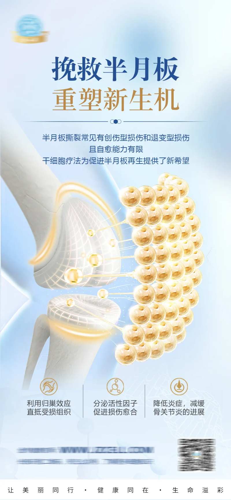 干细胞修复膝关节-采灵感-cailinggan.com