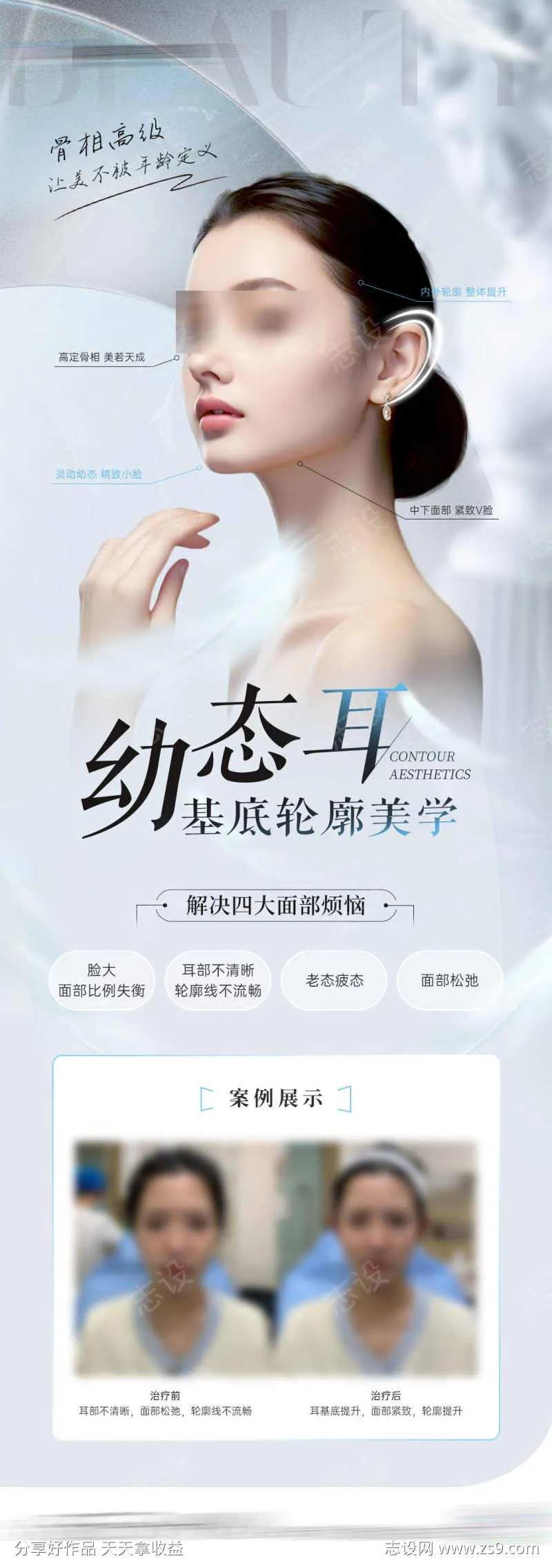 医美幼态耳轮廓海报-采灵感-cailinggan.com