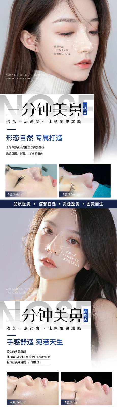 医美鼻综合案例系列海报-采灵感-https://www.cailinggan.com/