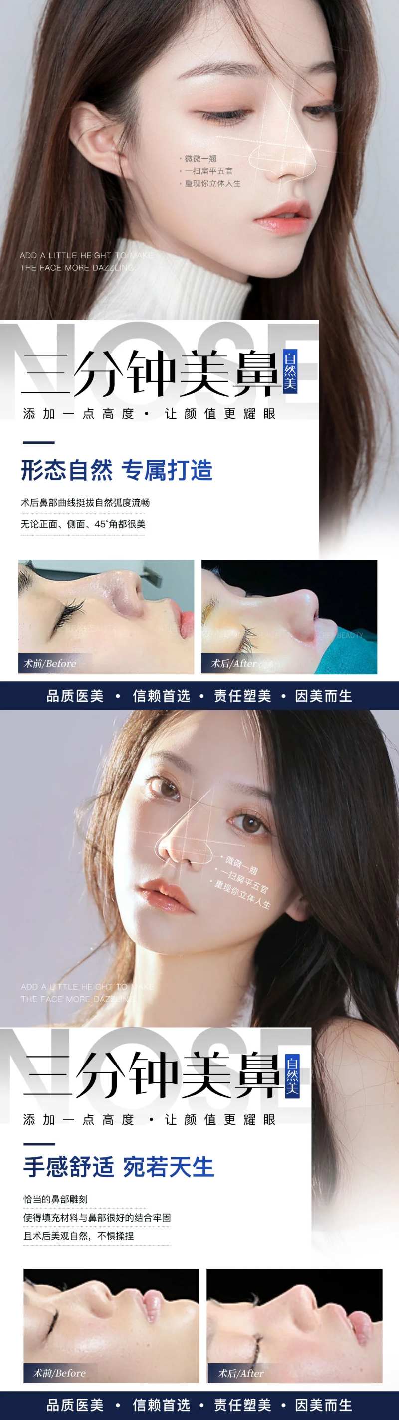 医美鼻综合案例系列海报-采灵感-cailinggan.com