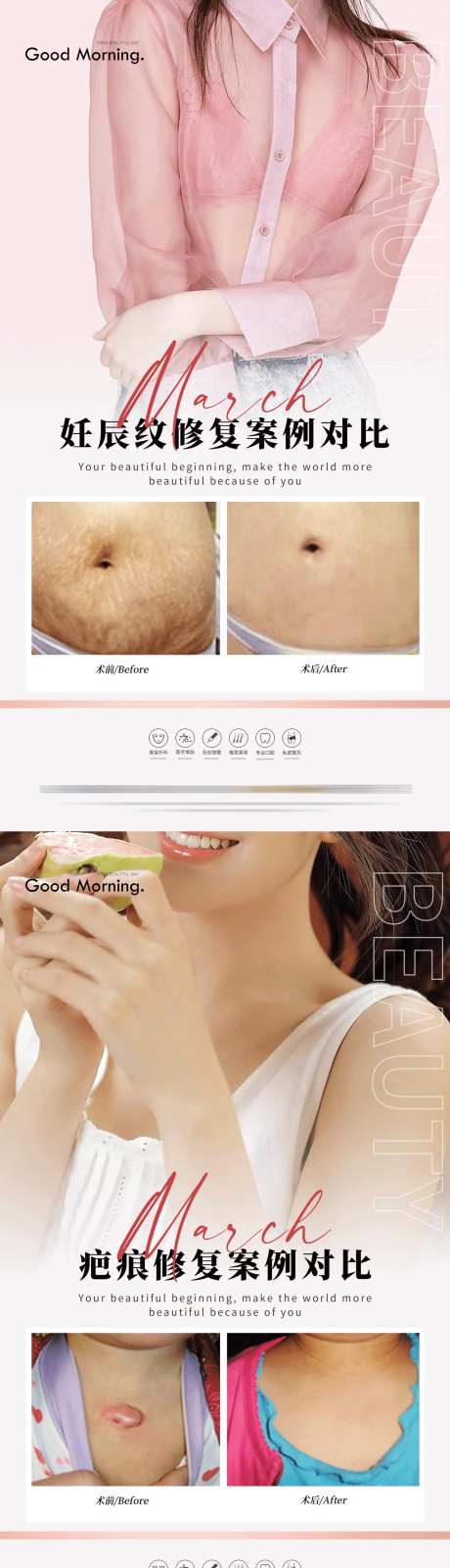 医美案例分享集系列海报-采灵感-https://www.cailinggan.com/