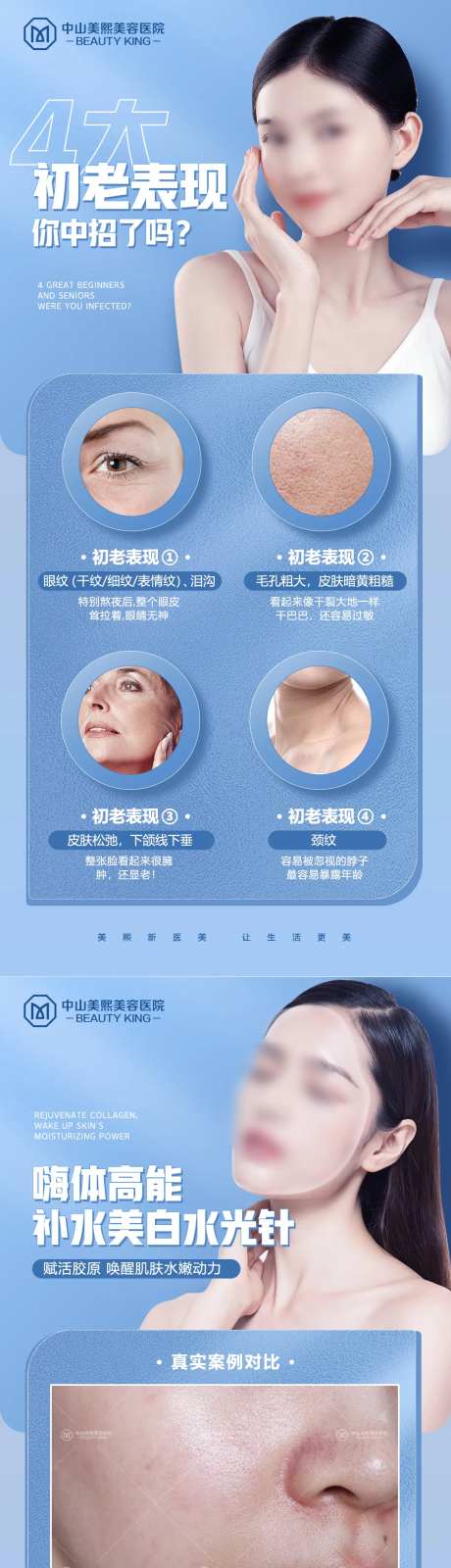 初老表现水光针案例海报-采灵感-https://www.cailinggan.com/