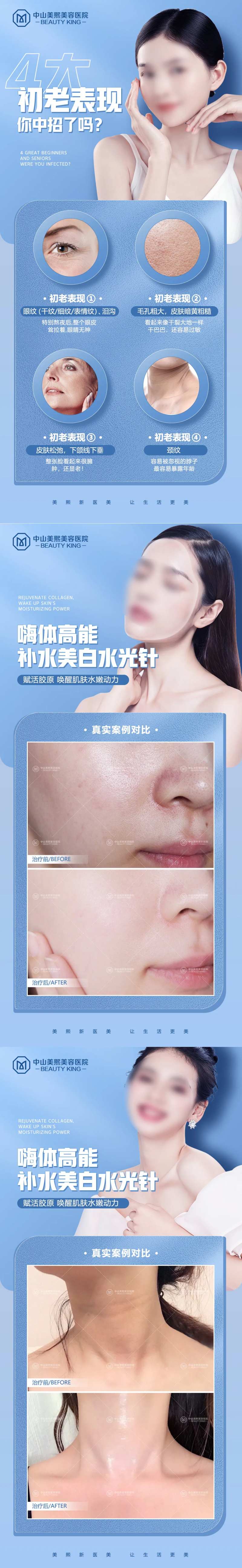 初老表现水光针案例海报-采灵感-cailinggan.com