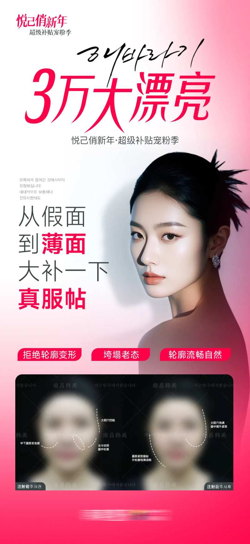 医美幼态脸3万大漂亮案例海报-采灵感-cailinggan.com