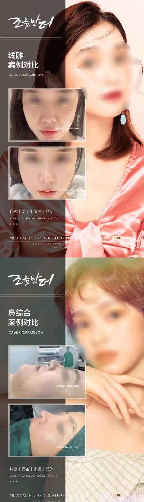 医美案例-采灵感-cailinggan.com