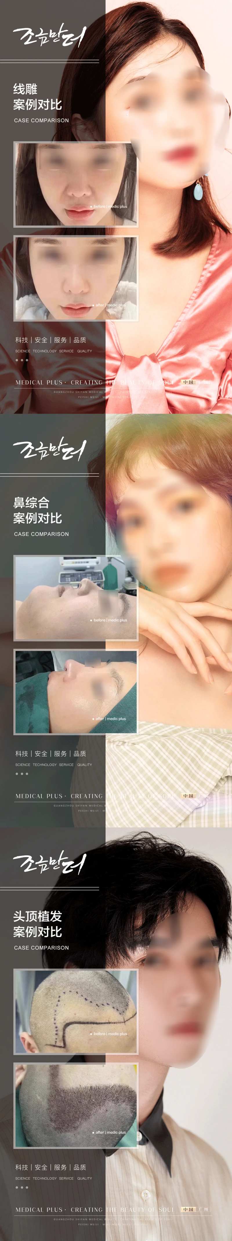 医美案例-采灵感-cailinggan.com