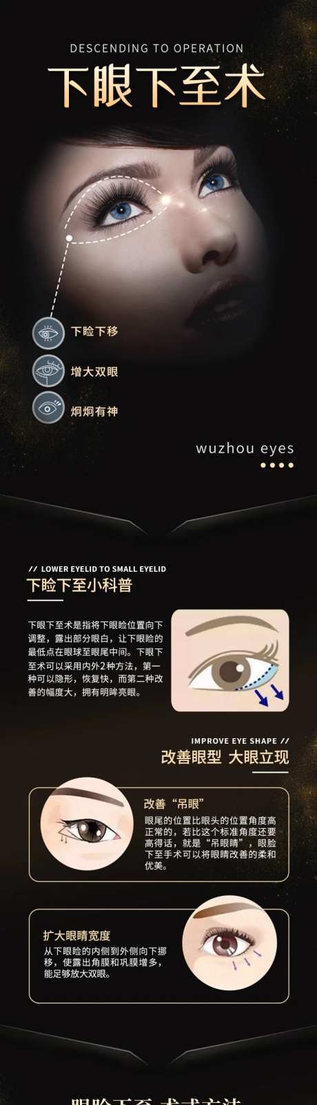 下眼下至术医美长图-采灵感-https://www.cailinggan.com/