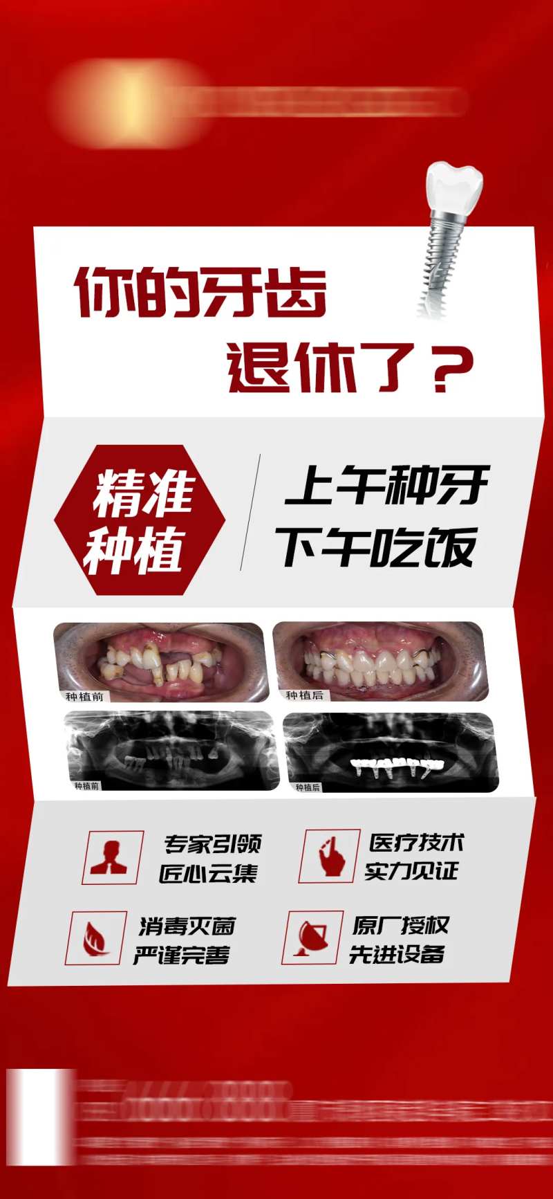 牙齿种植-采灵感-cailinggan.com