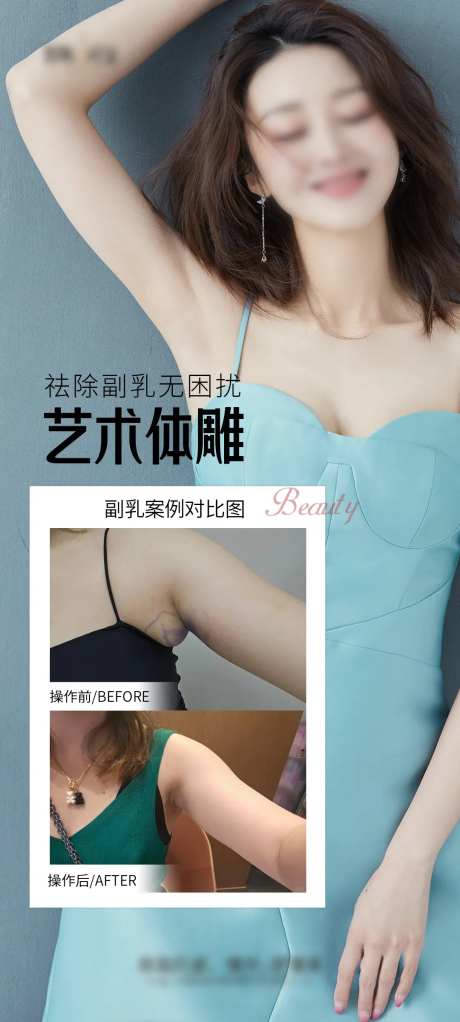 祛除副乳案例海报-采灵感-https://www.cailinggan.com/