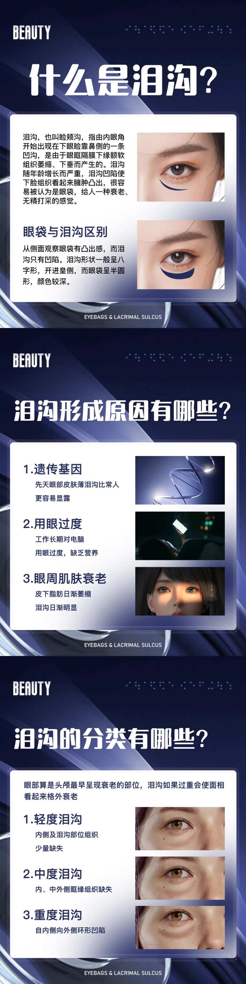 医美泪沟科普系列海报-采灵感-cailinggan.com