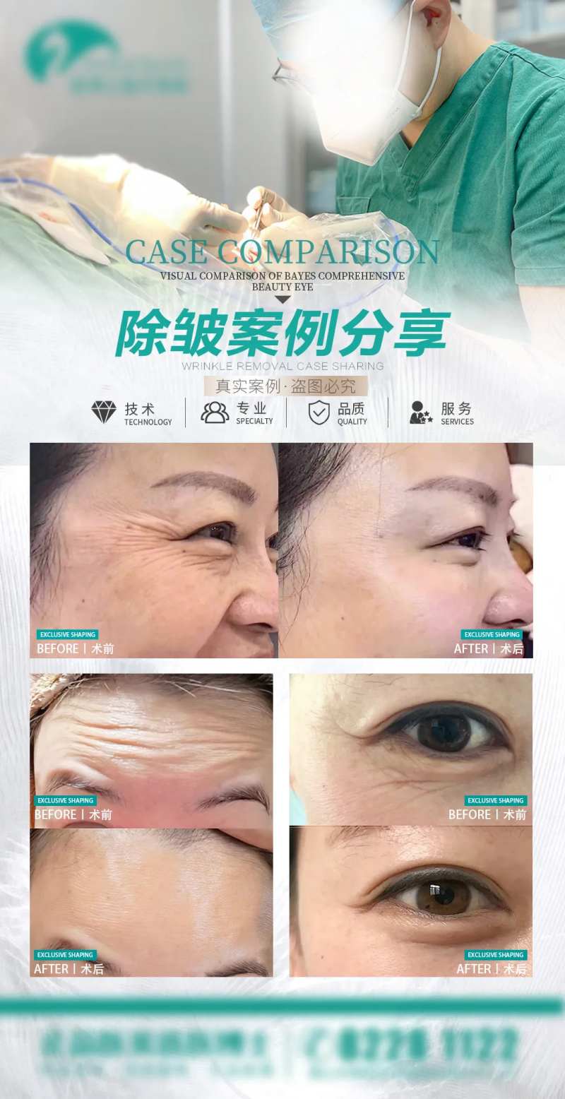 医美除皱案例分享-采灵感-cailinggan.com