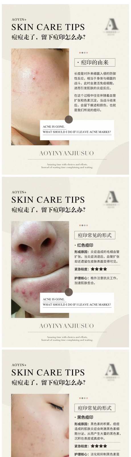 痘印由来与分类常识干货分享系列海报-采灵感-https://www.cailinggan.com/