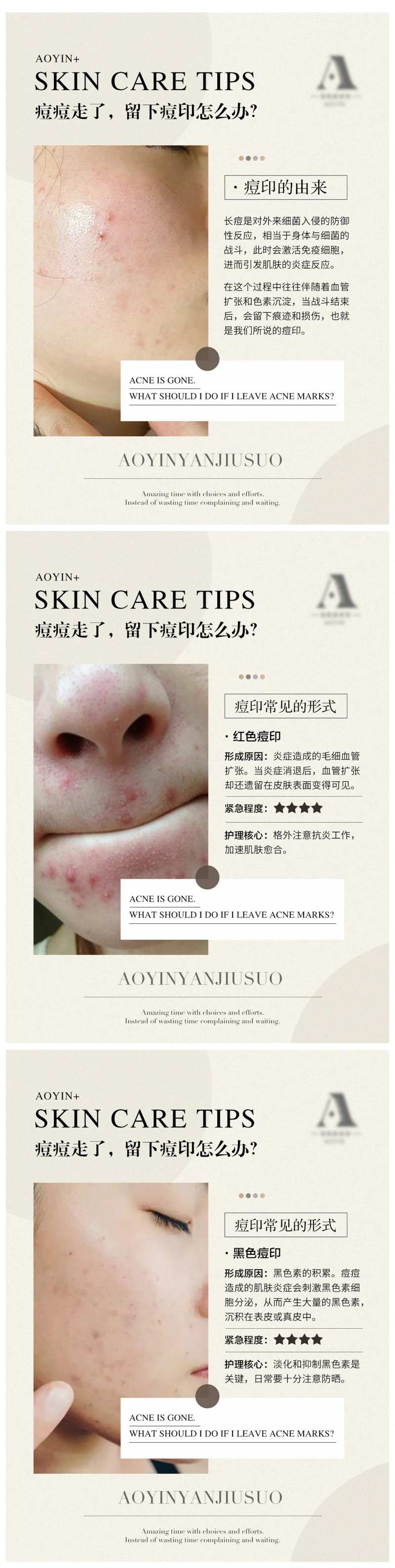 痘印由来与分类常识干货分享系列海报-采灵感-cailinggan.com