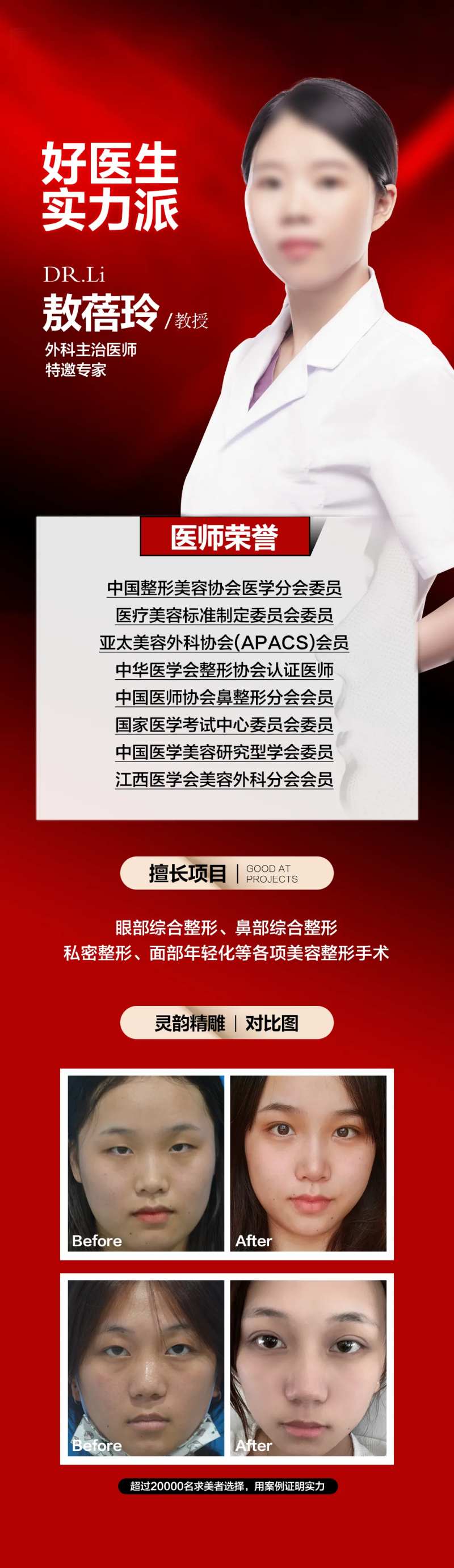 医美眼整形专家介绍案例对比海报-采灵感-cailinggan.com