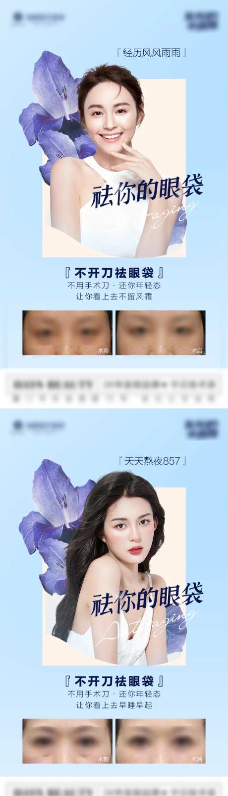 不开刀祛眼袋-采灵感-https://www.cailinggan.com/