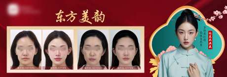 医美东方美韵对比案例海报展板-采灵感-https://www.cailinggan.com/