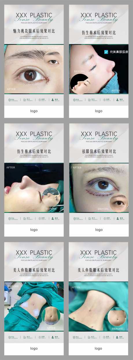 医美整形案例对比海报-采灵感-https://www.cailinggan.com/