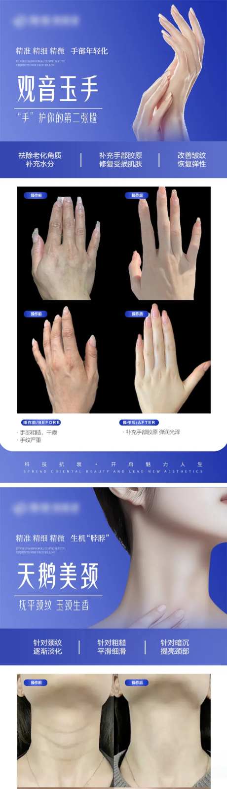 医美手部颈部抗衰案例对比宣传系列海报-采灵感-https://www.cailinggan.com/